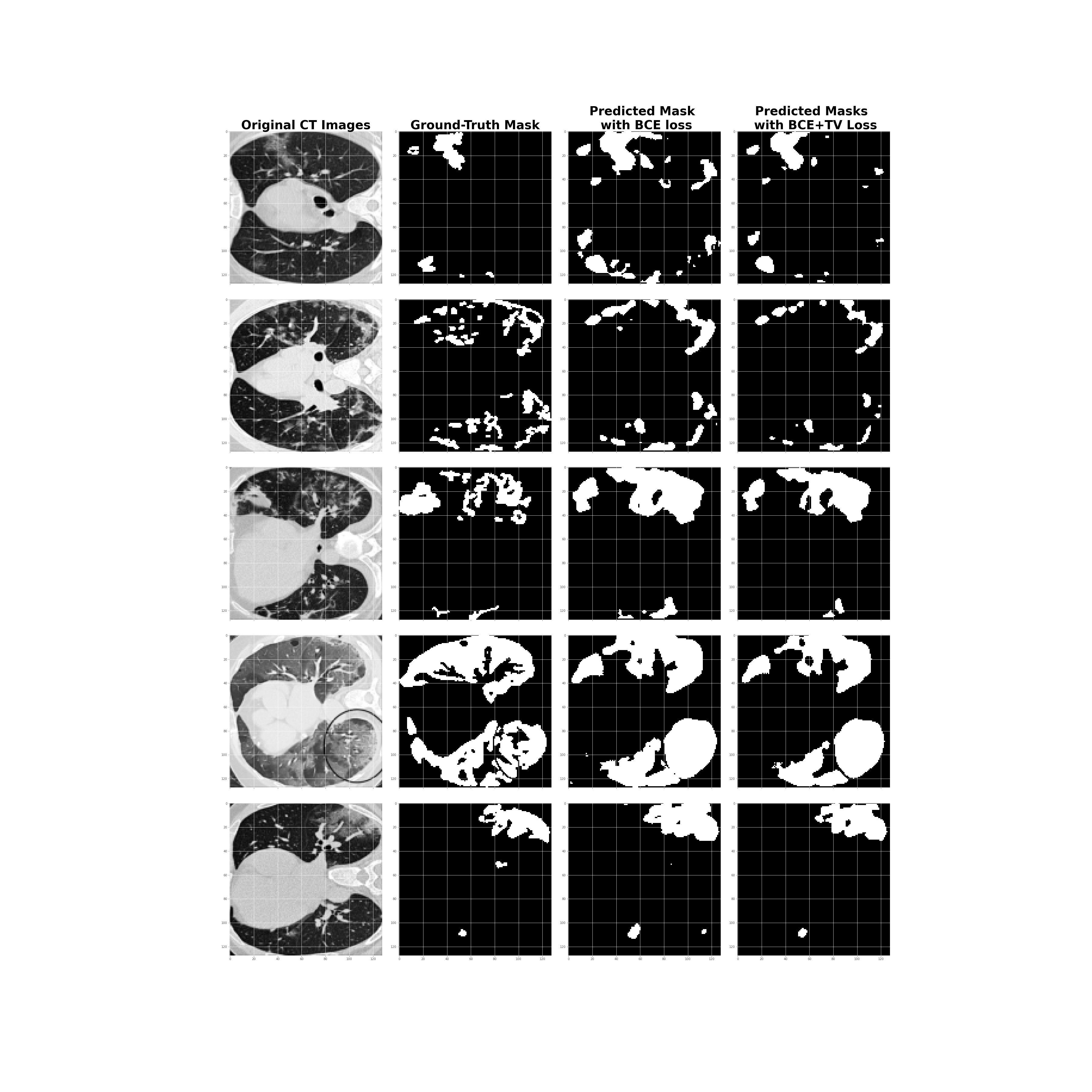 True and predicted masks of CTs scans. 